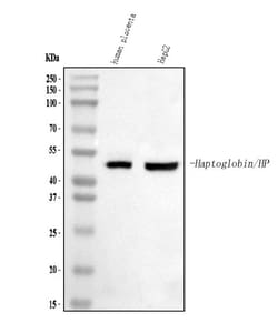 Invitrogen Haptoglobin Polyclonal Antibody 100 &mu;g; Unconjugated:Antibodies,