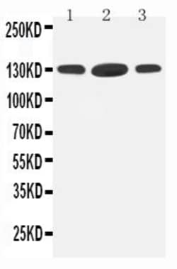 Invitrogen HDAC6 Polyclonal Antibody 100 &mu;g; Unconjugated:Antibodies,