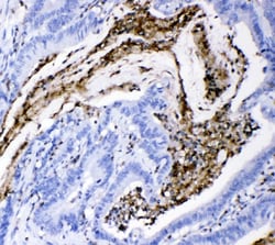 Invitrogen CD18 Polyclonal Antibody 100 &mu;g; Unconjugated:Antibodies,