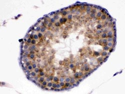 Invitrogen Kallikrein 5 Polyclonal Antibody 100 &mu;g; Unconjugated:Antibodies,