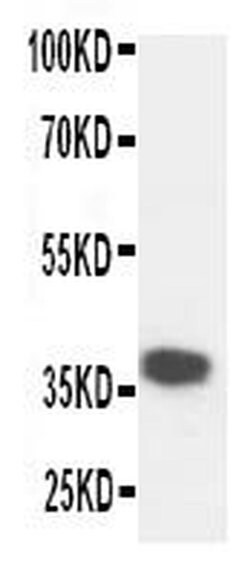 Invitrogen Kallikrein 5 Polyclonal Antibody 100 &mu;g; Unconjugated:Antibodies,