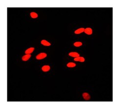 Invitrogen Ku80 Polyclonal Antibody 100 &mu;g; Unconjugated:Antikörper