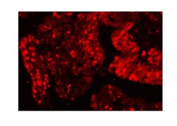 Invitrogen Ku80 Polyclonal Antibody 100 &mu;g; Unconjugated:Antikörper