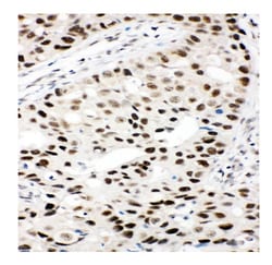 Invitrogen Ku80 Polyclonal Antibody 100 &mu;g; Unconjugated:Antikörper