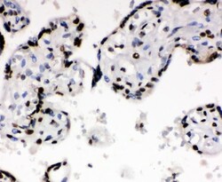 Invitrogen Ku70 Polyclonal Antibody 100 &mu;g; Unconjugated:Antibodies,