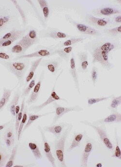 Invitrogen Ku70 Polyclonal Antibody 100 &mu;g; Unconjugated:Antibodies,