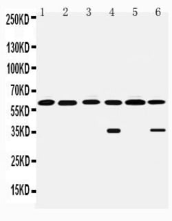 Invitrogen Monoamine Oxidase B Polyclonal Antibody 100 &mu;g; Unconjugated:Antibodies,