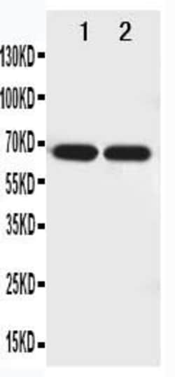 Invitrogen NTN1 Polyclonal Antibody 100 &mu;g; Unconjugated:Antibodies,