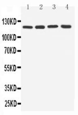 Invitrogen TLR7 Polyclonal Antibody 100 &mu;g; Unconjugated:Antibodies,