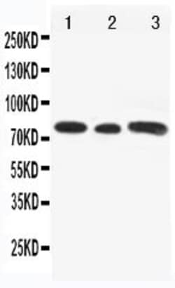 Invitrogen GLI3 Polyclonal Antibody 100 &mu;g | Buy Online | Invitrogen&trade; | Fisher Scientific