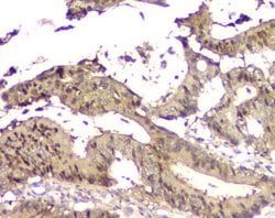 Invitrogen 14-3-3 sigma Polyclonal Antibody 100 &mu;g; Unconjugated:Antibodies,