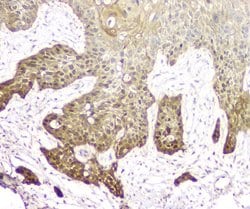Invitrogen 14-3-3 sigma Polyclonal Antibody 100 &mu;g; Unconjugated:Antibodies,
