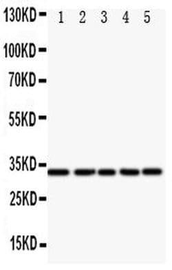Invitrogen E2F6 Polyclonal Antibody 100 &mu;g; Unconjugated:Antibodies,