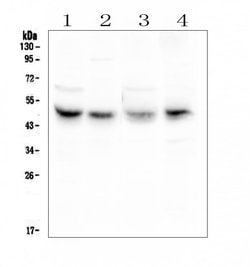 CAR Polyclonal Antibody, Invitrogen 100 &mu;g; Unconjugated:Antibodies,