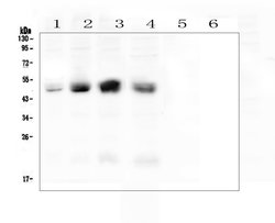 CAR Polyclonal Antibody, Invitrogen 100 &mu;g; Unconjugated:Antibodies,