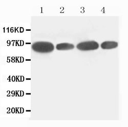 Invitrogen FES Polyclonal Antibody 100 &mu;g; Unconjugated:Antibodies,