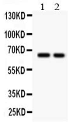 Invitrogen TGFBR2 Polyclonal Antibody 100 &mu;g; Unconjugated:Antibodies,