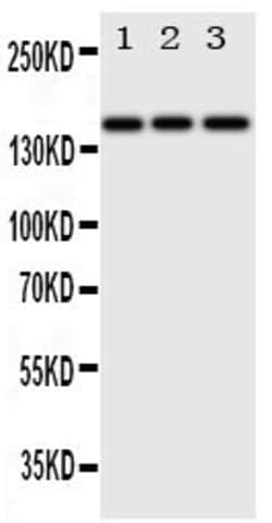 Invitrogen ErbB4 Polyclonal Antibody 100 &mu;g; Unconjugated:Antibodies,