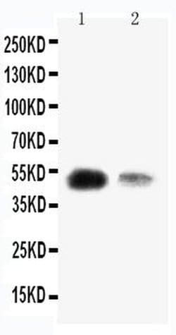 Invitrogen KLF8 Polyclonal Antibody 100 &mu;g; Unconjugated:Antibodies,