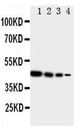 TRIF Polyclonal Antibody, Invitrogen 100 &mu;g; Unconjugated:Antibodies,