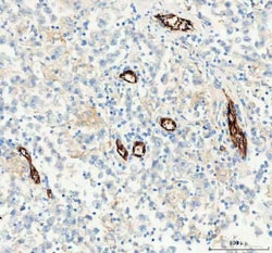 Invitrogen CD31 Polyclonal Antibody 100 &mu;g; Unconjugated:Antibodies,