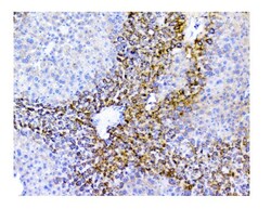 Invitrogen SQSTM1 Polyclonal Antibody 100 &mu;g; Unconjugated:Antikörper