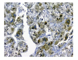 Invitrogen SQSTM1 Polyclonal Antibody 100 &mu;g; Unconjugated:Antikörper