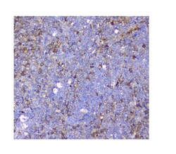 Invitrogen SQSTM1 Polyclonal Antibody 100 &mu;g; Unconjugated:Antikörper