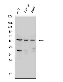 Invitrogen SQSTM1 Polyclonal Antibody 100 &mu;g; Unconjugated:Antikörper