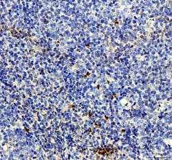 Invitrogen NRG1 Polyclonal Antibody 100 &mu;g; Unconjugated:Antibodies,