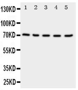 Invitrogen NRG1 Polyclonal Antibody 100 &mu;g; Unconjugated:Antibodies,