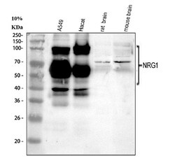 Invitrogen NRG1 Polyclonal Antibody 100 &mu;g; Unconjugated:Antibodies,