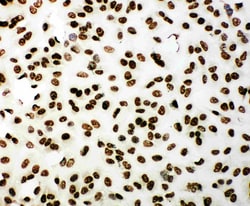 Invitrogen 53BP1 Polyclonal Antibody 100 &mu;g; Unconjugated:Antibodies,