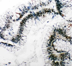 Invitrogen 53BP1 Polyclonal Antibody 100 &mu;g; Unconjugated:Antibodies,
