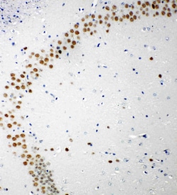 Invitrogen 53BP1 Polyclonal Antibody 100 &mu;g; Unconjugated:Antibodies,