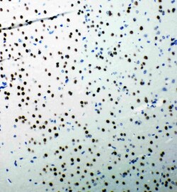 Invitrogen 53BP1 Polyclonal Antibody 100 &mu;g; Unconjugated:Antibodies,