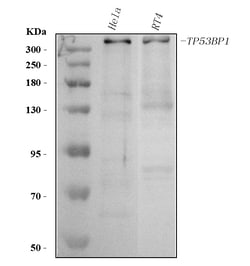 Invitrogen 53BP1 Polyclonal Antibody 100 &mu;g; Unconjugated:Antibodies,