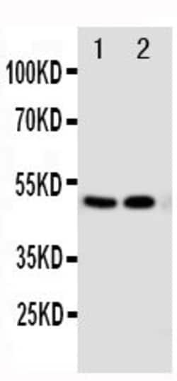 Invitrogen VDR Polyclonal Antibody 100 &mu;g | Buy Online | Invitrogen&trade; | Fisher Scientific