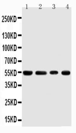 Invitrogen TRAF4 Polyclonal Antibody 100 &mu;g; Unconjugated:Anticuerpos
