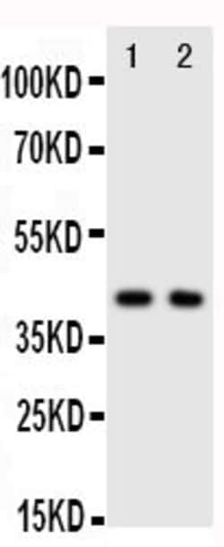 Invitrogen CXCR5 Polyclonal Antibody 100 &mu;g; Unconjugated:Antibodies,