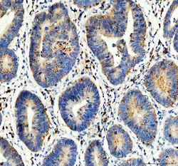 Invitrogen Flotillin 1 Polyclonal Antibody 100 &mu;g | Buy Online | Invitrogen&trade; | Fisher Scientific