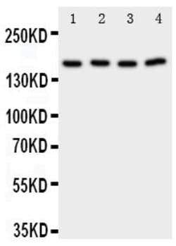 Invitrogen PLA2G4A Polyclonal Antibody 100 &mu;g; Unconjugated:Antibodies,