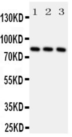 Invitrogen RSK1 Polyclonal Antibody 100 &mu;g | Buy Online | Invitrogen&trade; | Fisher Scientific
