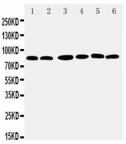Invitrogen RSK1 Polyclonal Antibody 100 &mu;g | Buy Online | Invitrogen&trade; | Fisher Scientific