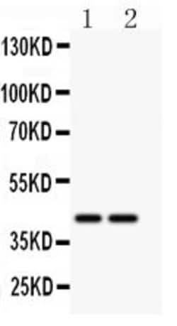 Invitrogen CD244 Polyclonal Antibody 100 &mu;g; Unconjugated:Antibodies,