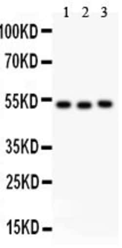 Invitrogen Factor VII Polyclonal Antibody 100 &mu;g; Unconjugated:Antibodies,