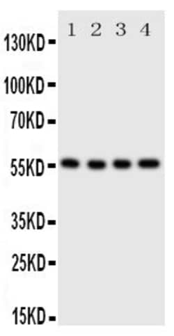 Invitrogen SLC2A5 Polyclonal Antibody 100 &mu;g; Unconjugated:Antibodies,