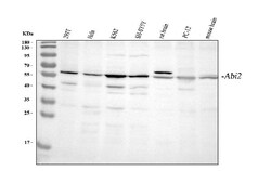 Invitrogen ABI2 Polyclonal Antibody 100 μg; Unconjugated:Antibodies,