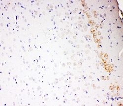 Invitrogen ALDH2 Polyclonal Antibody 100 &mu;g | Buy Online | Invitrogen&trade; | Fisher Scientific