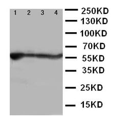 Invitrogen ALDH2 Polyclonal Antibody 100 &mu;g | Buy Online | Invitrogen&trade; | Fisher Scientific